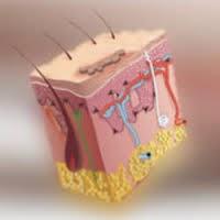 Dermatitis seborréica