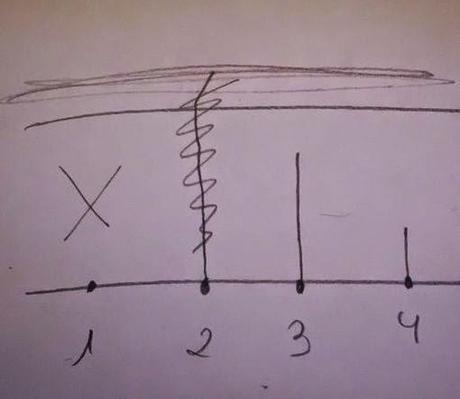 Depilación Laser Soprano, primeros resultados e impresiones sistema de fotodepilacion