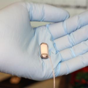 Aparato Implantado Controla la Artritis ReumatoideEn las ...