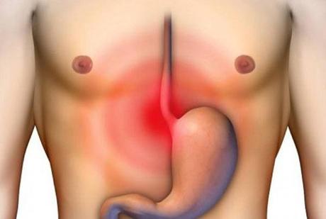 ¿Qué es y qué causa la esofagitis eosinofílica?