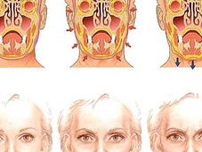 Cómo envejece rostro