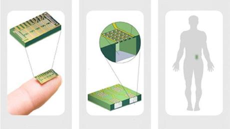 Crean un microchip para controlar la natalidad a través de comunicaciones inalámbricas