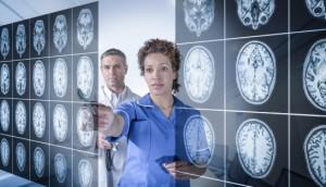 Estudio del cerebro