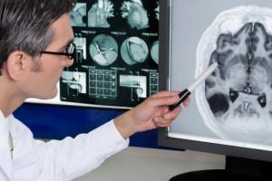 Doctor estudiando el cerebro humano