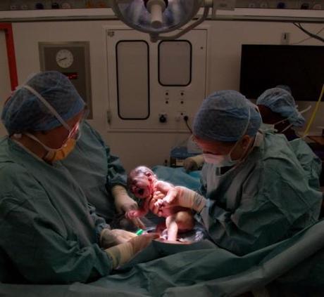 Nuevo dispositivo para evitar desgarros durante el parto Salud durante el parto