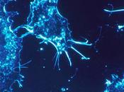 Células troncales, útiles Alzheimer Parkinson