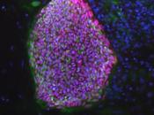Crean células madre embrionarias diploides para curar diabetes