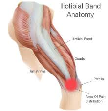 Sindrome cintilla iliotibial