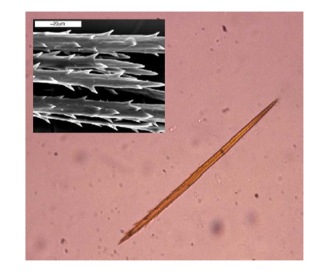 Imagen al microscopio óptico de un pelo urticante (x40). Con microscopía electrónica (arriba). Tomado de Vega et al., 2011.