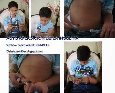 APLICACIÓN DE  LA INYECION DE INSULINA PARA DIABETICOS
