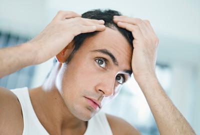 Más del 50% de los hombres sufren pérdida de cabello.