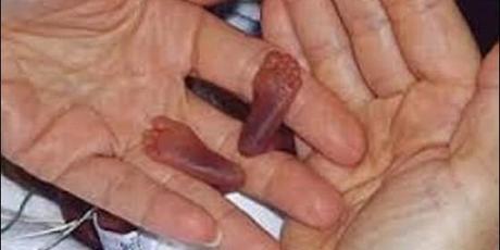 EN GRAN BRETAÑA QUEMAN FETOS DE NIÑOS ABORTADOS