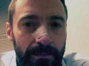 Hugh Jackman, tratamiento cáncer nariz
