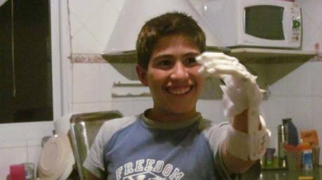 Jovenes desarrollaron una protesis con una impresora 3D.