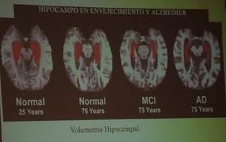 IX Curso para familiares y cuidadores de pacientes con Alzheimer