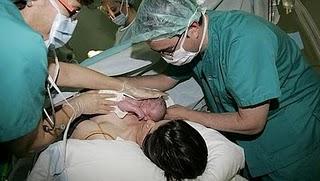 En España se practican demasiadas cesáress según la OMS