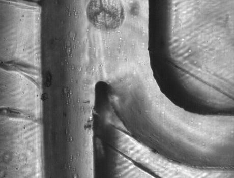 Desarrollan un microchip ultrasónico para separar células tumorales de la sangre