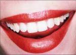 rico blanqueador dientes