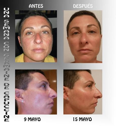 germaine de capuccini, timexpert, ro & che's, salon de belleza, cosmética profesional