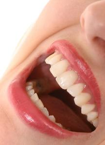 Sonrisas Vitaldent