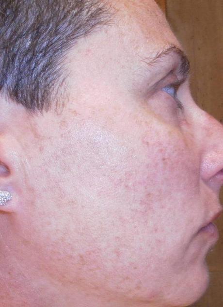 blog soloyo, rutina facial limpieza, tónico cosmética natural, bioirki, maquillaje total, belleza