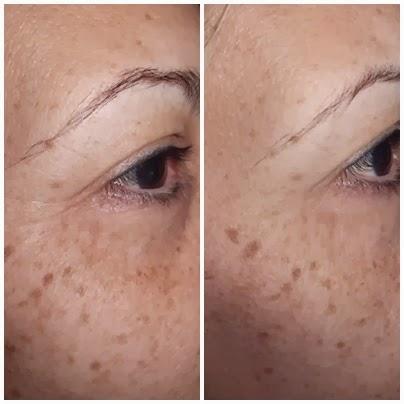 mascarilla facial 