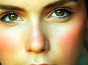 Nuestro decálogo sobre rosácea