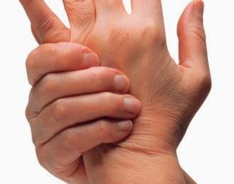 ¿Inflamación en las articulaciones? Cuidado podría ser Artritis