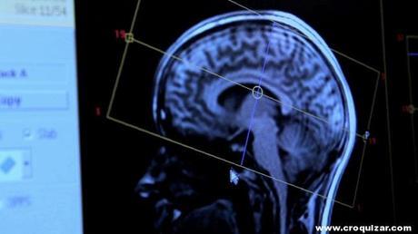 El escaneo cerebral podría diseñar productos “científicamente perfectos” Merel-Bekking-Croquizar-0