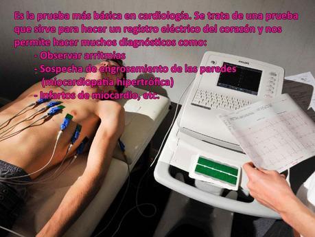 electrocardiograma copia