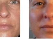 Rutina Facial TIMEXPERT SRNS Germaine Capuccini desmaquillante Ojos.