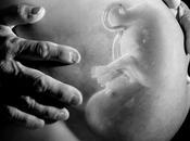 Distrofia Muscular Duchenne (DMD): torneo solidario favor asociación Parent Project