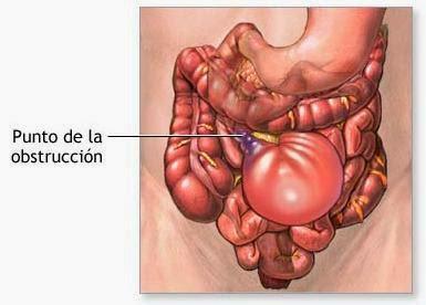 Limpieza, depuración, detoxificación...