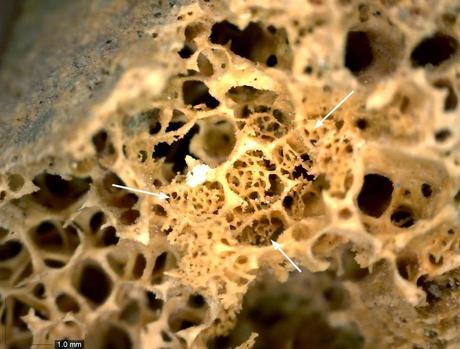 Paleooncología Paleooncología