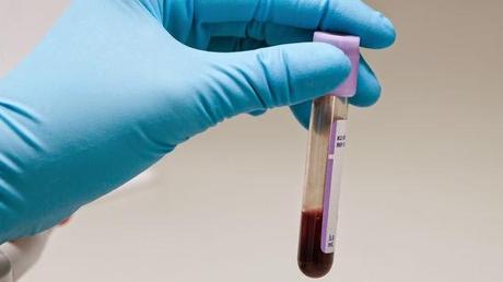 DESCUBREN UNA SANGRE 50 VECES MAS POTENTE QUE LA HUMANA !!