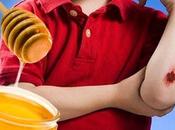 miel cura heridas detiene crecimiento bacterias