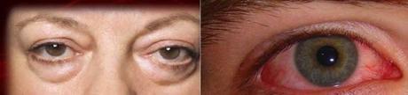 BELLEZA Y CUIDADO DE LOS OJOS BELLEZA Y CUIDADO DE LOS OJOS