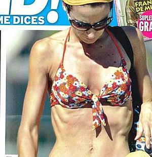 La anorexia de las Ortíz Rocasolano