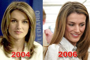 La anorexia de las Ortíz Rocasolano