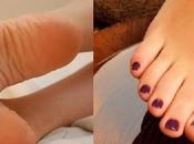 pies molestos callos