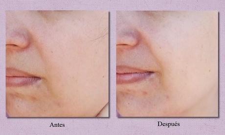 Las mascarillas “Saladit Essential Juice Sheet Mask” de ONL – extractos de verduras para la belleza de la piel (From Asia With Love) Las mascarillas “Saladit Essential Juice Sheet Mask” de ONL – extractos de verduras para la belleza de la piel (From Asia With Love)