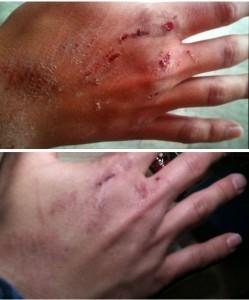 Caída en bicicleta He probado: ¡Y Sin Carnet!