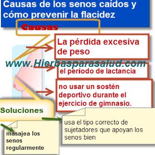 ¿Qué causa los senos caídos y cómo prevenir la flacidez?