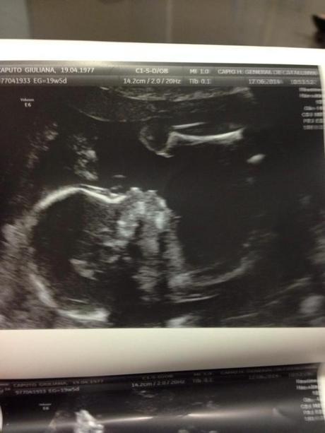 Miércoles Mudo – Sorpresa!! Es una niña!!! 20 semanas