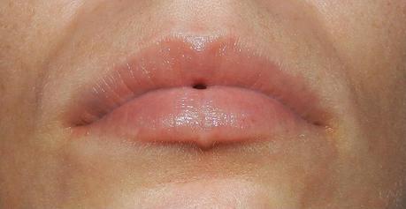 LIP DR.KITZINGER MICRO GEL