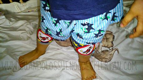 PROBAMOS CRAZY ZEBRA PROBAMOS CRAZY ZEBRA