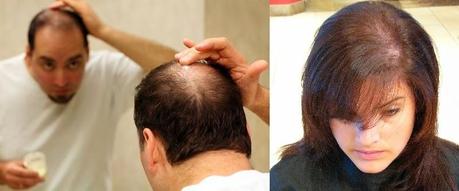 TRES VITAMINAS QUE EVITAN LA CAIDA DEL CABELLO