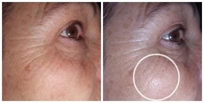 Benefiance, Shiseido