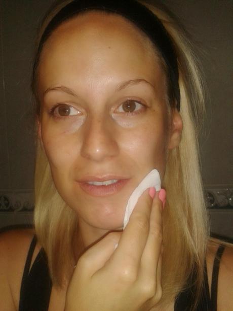 Radiofrecuencia facial, con Tripollar Stop