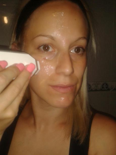 Radiofrecuencia facial, con Tripollar Stop